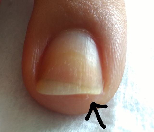 Nutrientes Essenciais para Unhas Fortes