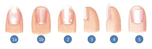 Melhores Bases Niveladoras para Unhas Estriadas