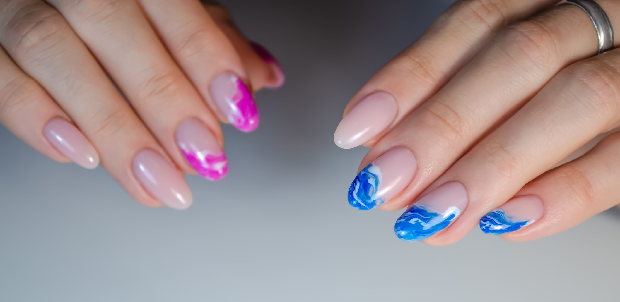 quanto custa tratamento para unhas onduladas