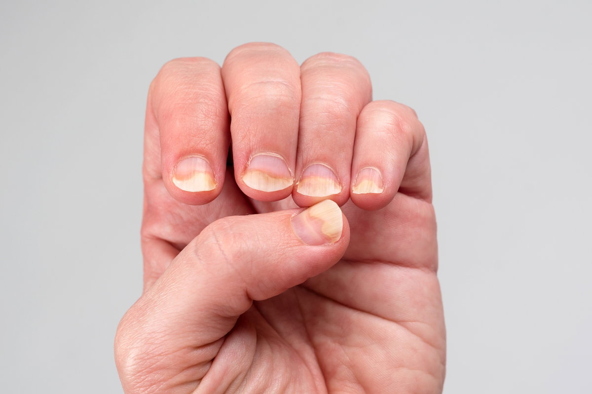 10 dicas para unhas lisas e saudáveis