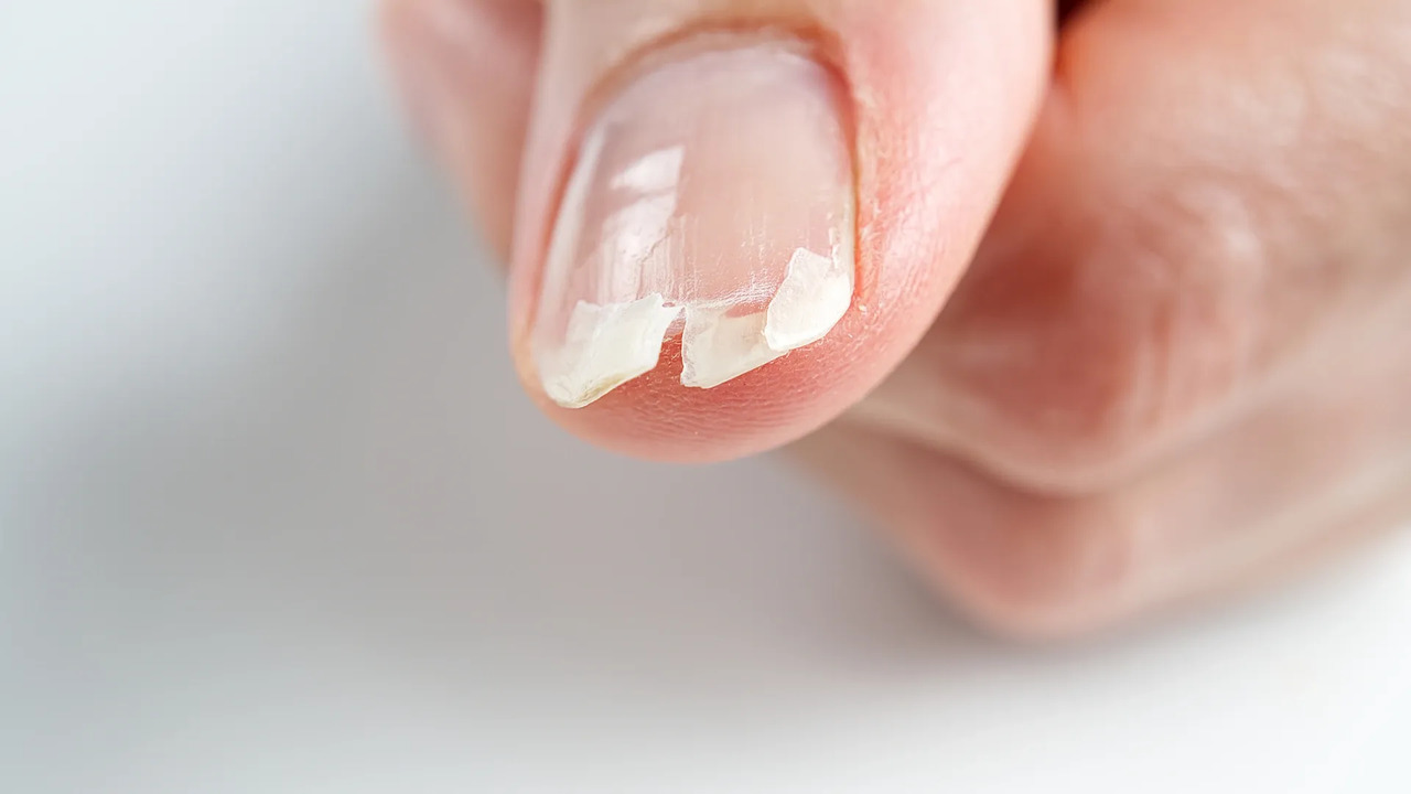 5 dicas unhas fortes saudaveis