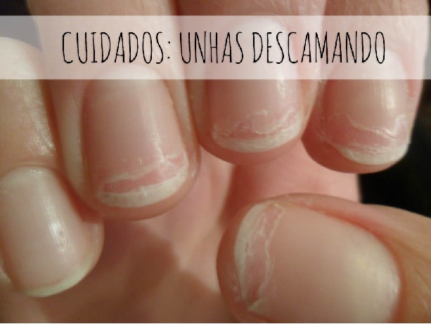 erros comuns unhas quebradicas