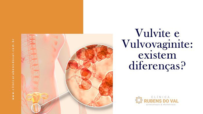 1. Vulvovaginite em Crianças: Causas