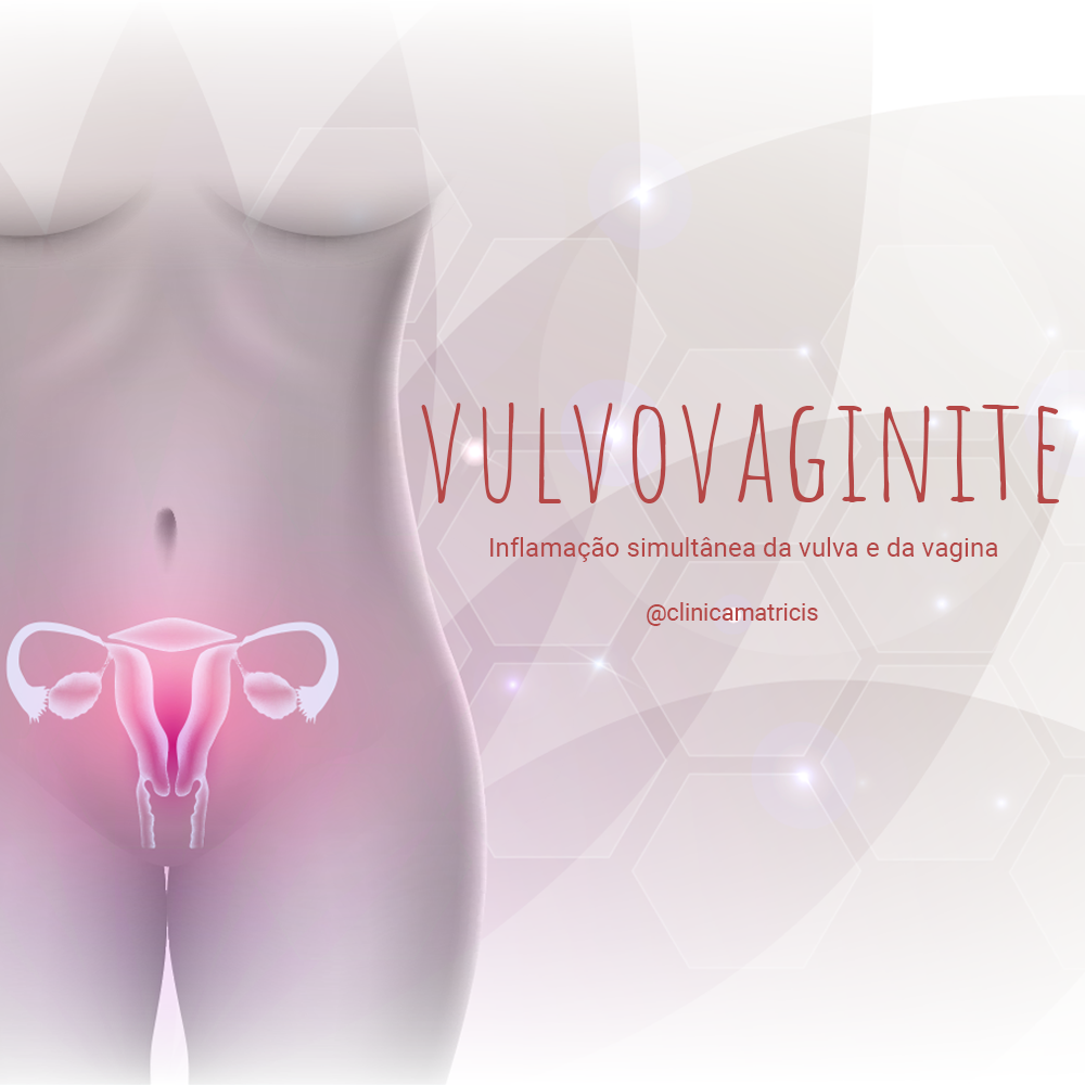 vulvovaginite
