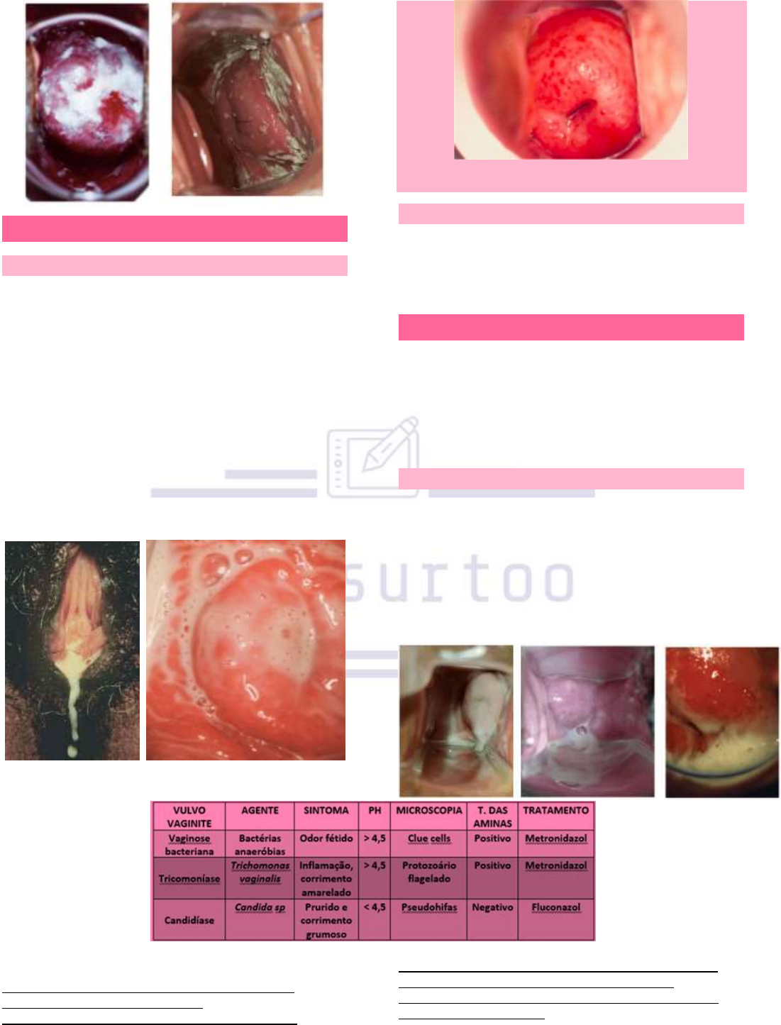 1. Vulvovaginite em Crianças: Causas