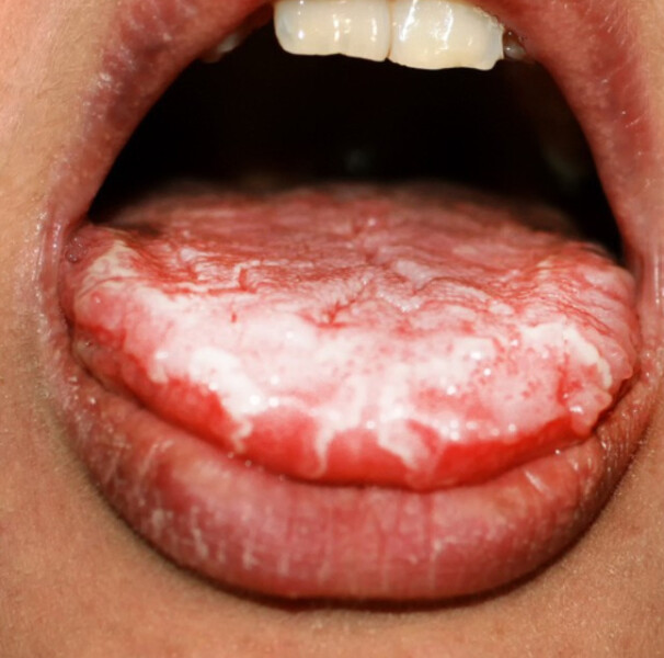 labios pálidos causas