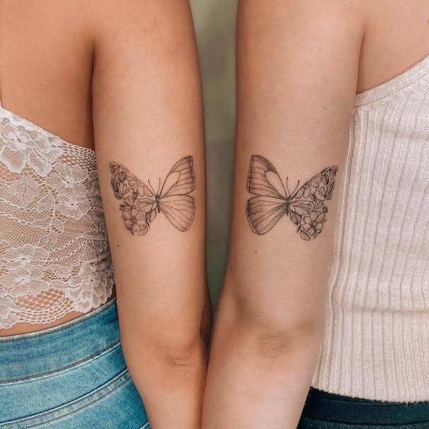 orçamento remoção tatuagem