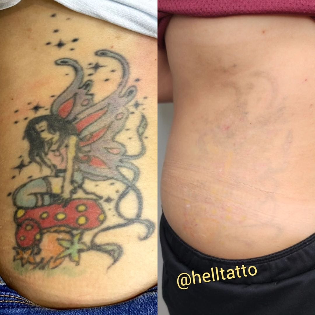 fases cicatrização tatuagem