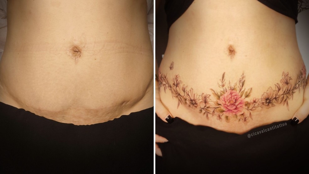 fases da cicatrização tatuagem