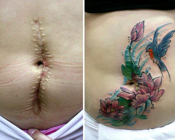 cuidados pós tatuagem