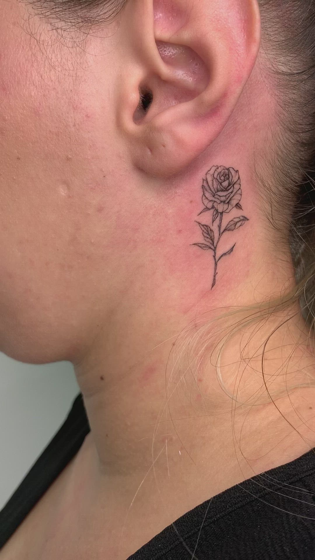 dor tatuagem pescoço